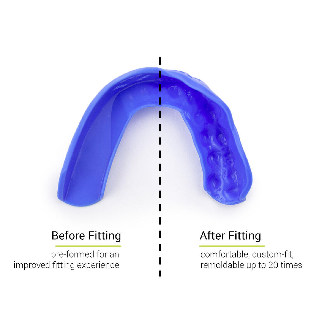 3D - Protège-dents Taille unique - Bleu royal 3/6