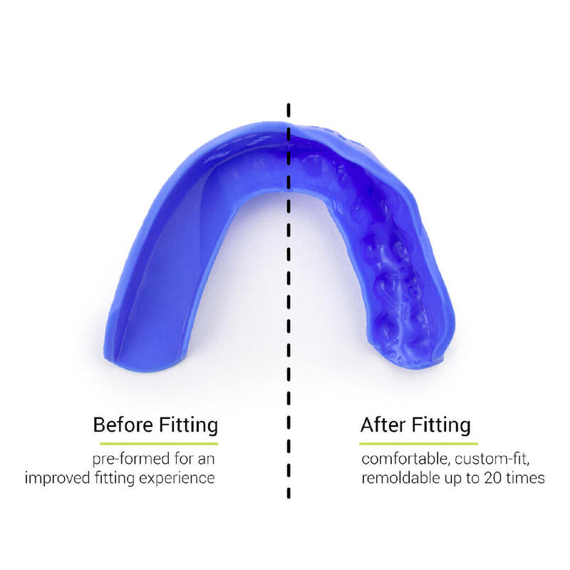 Protector dental Sisu 3D