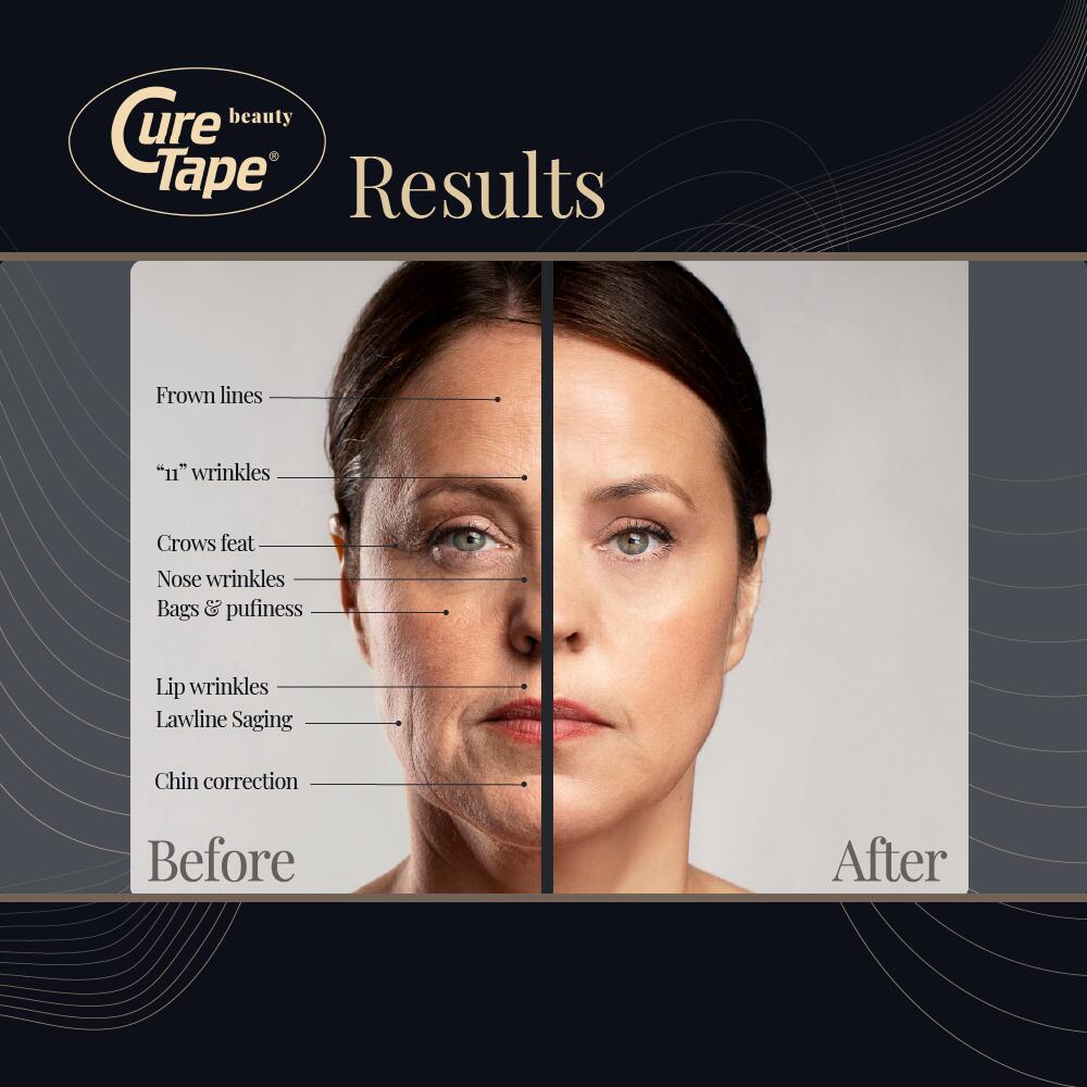 CureTape® Beauty – Body & Face Tape 5/8