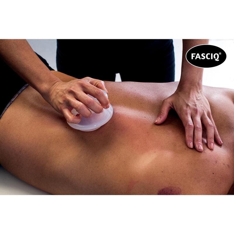 FASCIQ® Sports Cupping Set - Taças para pontos de gatilho