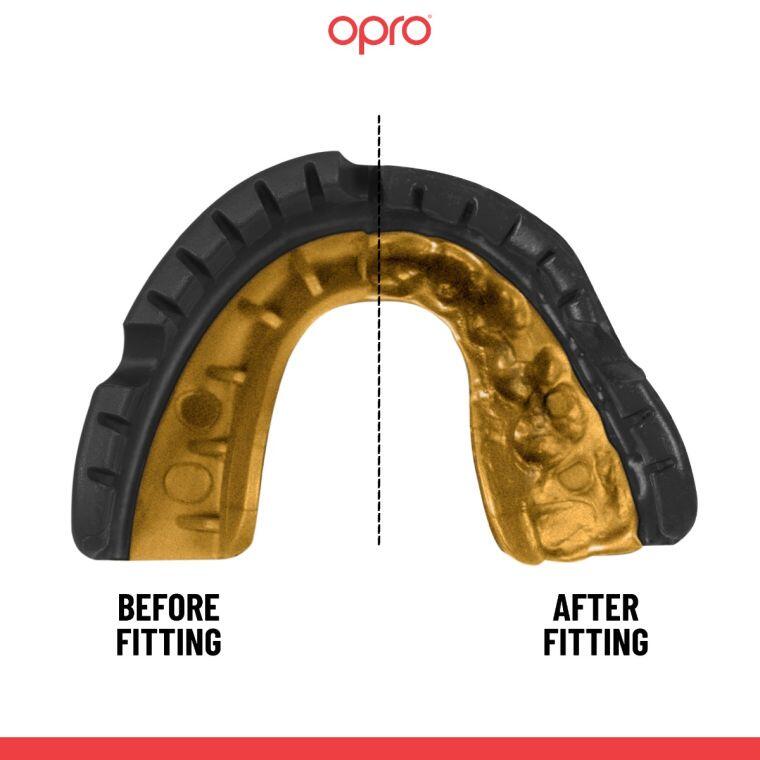 Black-Gold Opro Gold Braces Self-Fit Mouth Guard 4/6