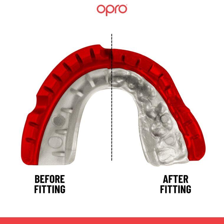 OPRO Paradenti d'oro autoadesivi Anelli dentali