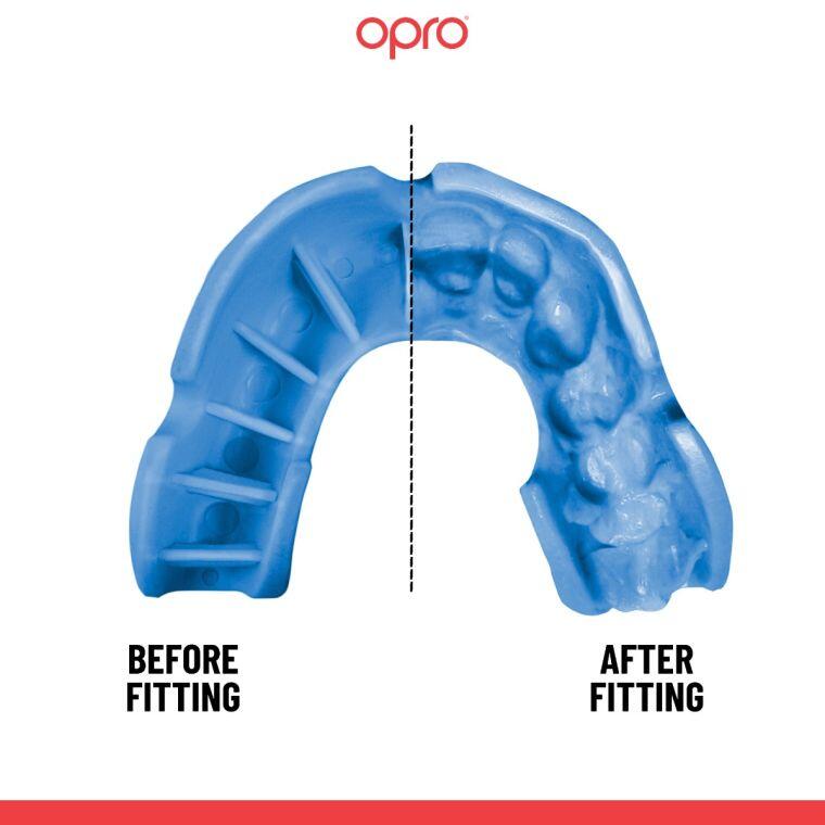 Protetor Bucal Opro Silver Azul Para Adulto 5/5