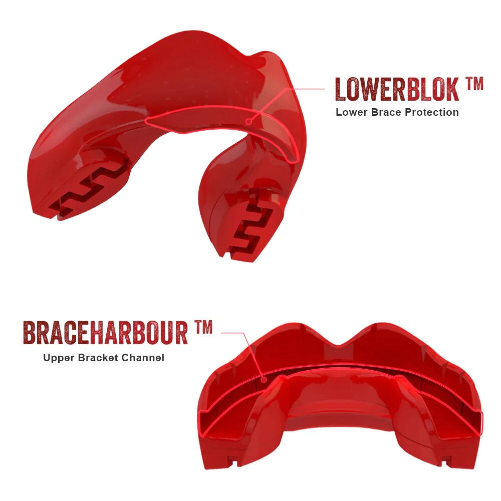 SAFEJAWZ Ortho Series Self-Fit Mouth Guard for Braces 4/6
