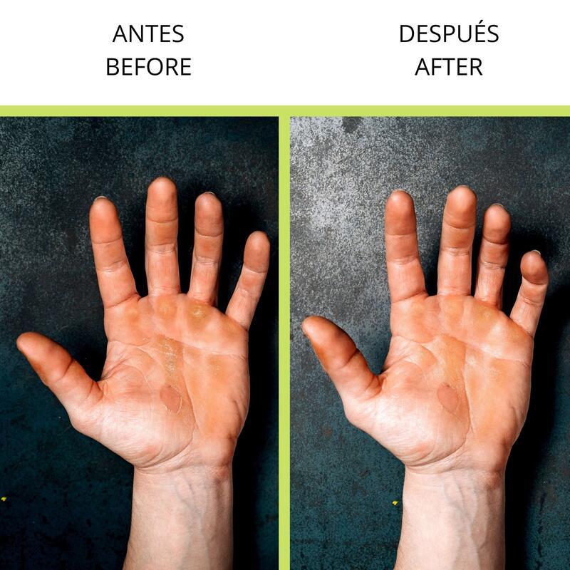 Pierre de callosités vélites