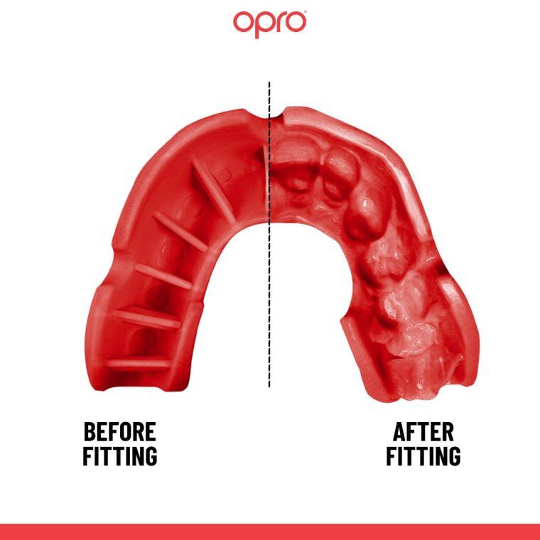 OPRO Self-Fit - Silver - Black/Red 5/7