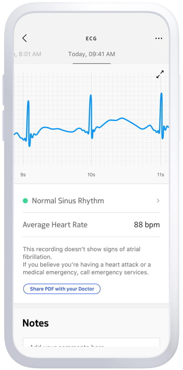 WITHINGS BPM Core - Misuratore pressione, stetoscopio e elettrocardiogramma 7/7
