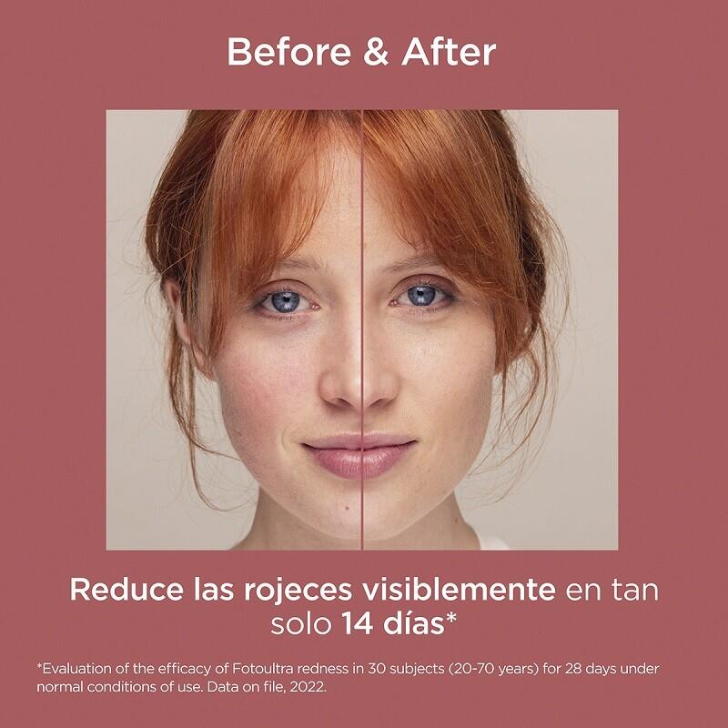 ISDIN FotoUltra Redness SPF 50+ (50ml) 3/7
