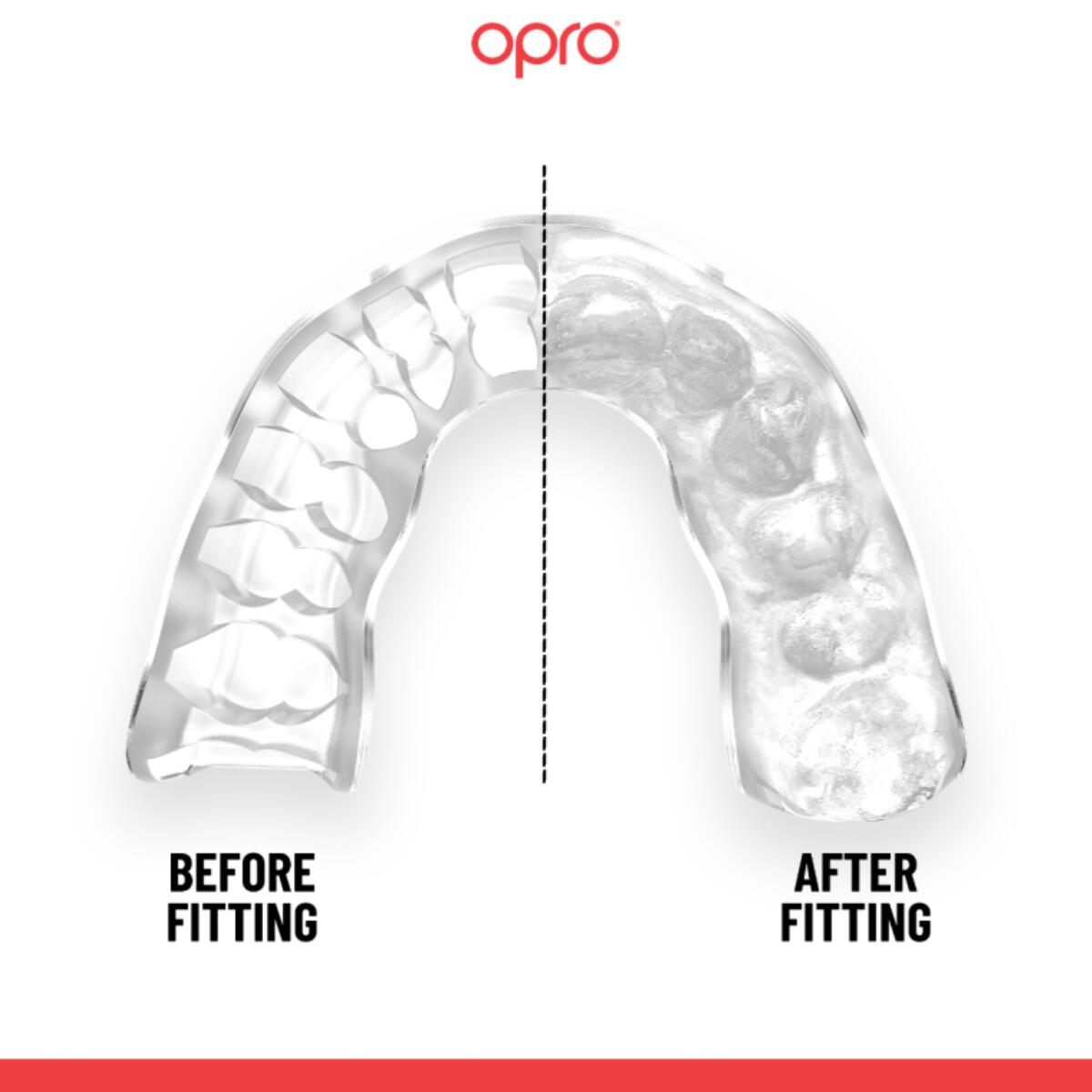 Protège-dents Instant Custom Fit OPRO Bagues – Transparent 4/7