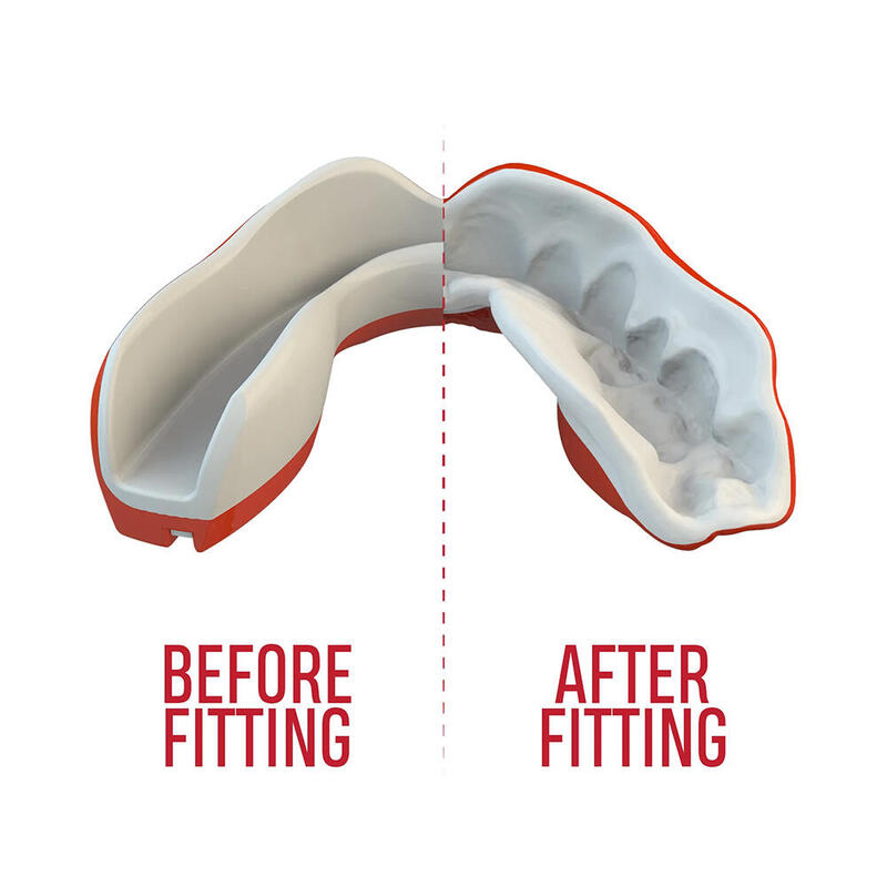 Protège dents pour adulte SafeJawz Extro Series Viper Rouge
