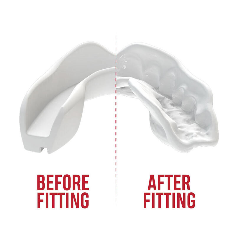 Protège dents pour enfant SafeJawz Intro Series Blanc