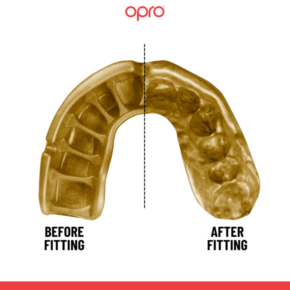 Zelfaanpassende gebitsbeschermer Opro GEN5 Gold Grillz 5/7