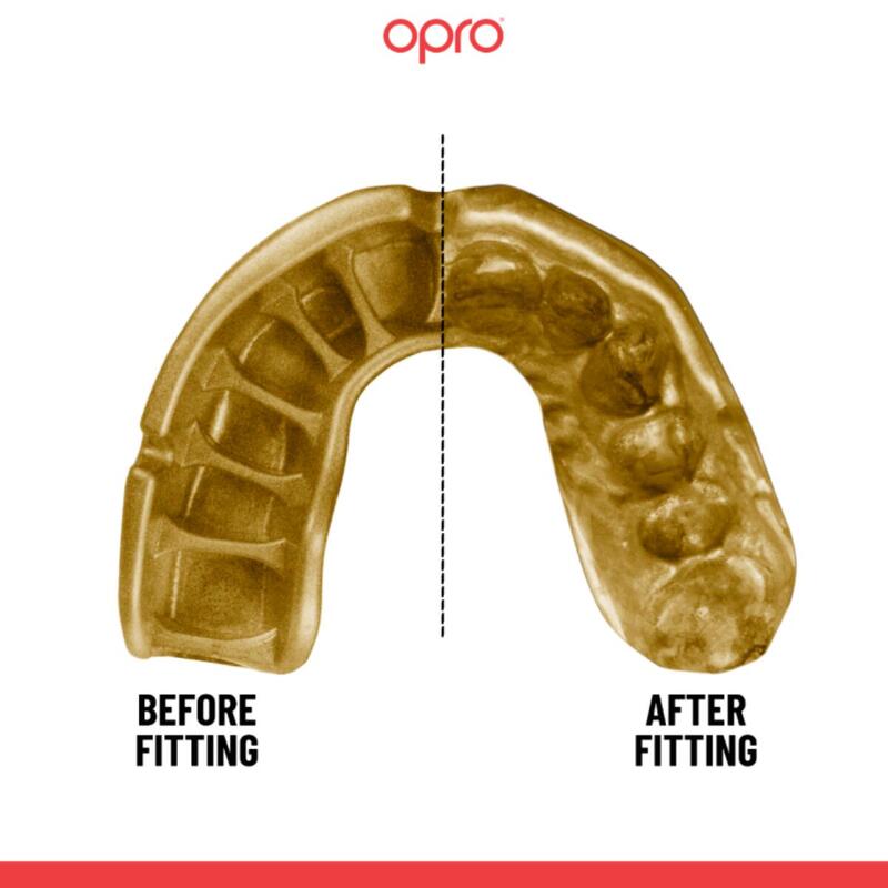 Ochraniacz na Zęby Opro Gold GEN5 Grillz