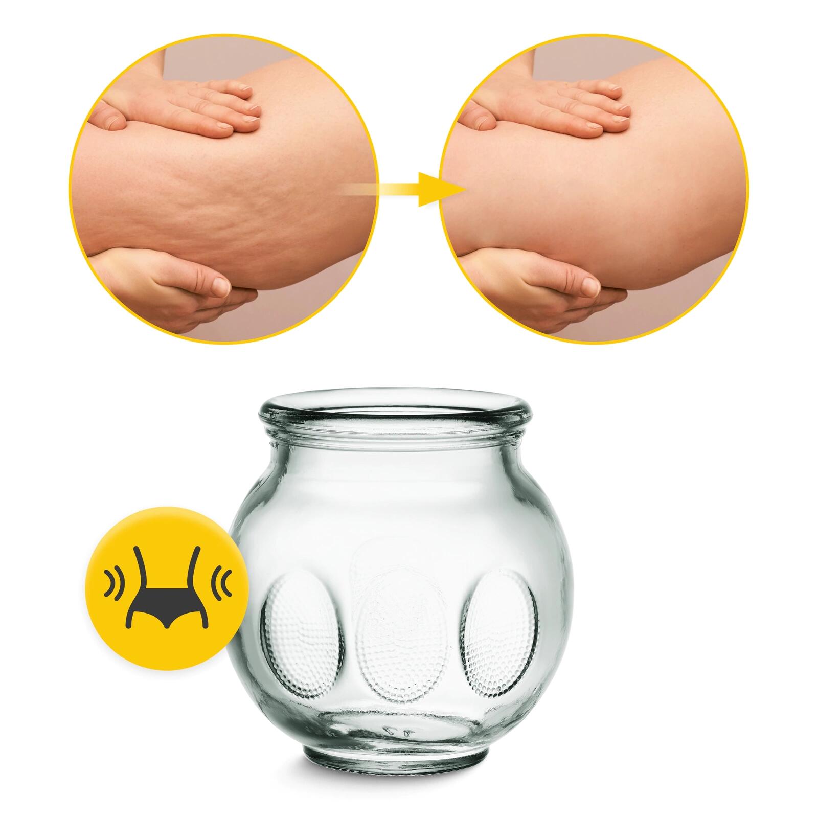 Skleněné baňky na baňkování 4FIZJO 5/7