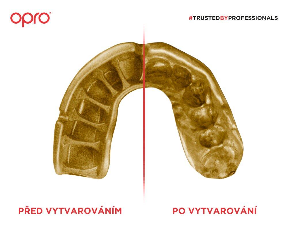 Protège-dents OPRO UFC Gold – Noir/Or 3/7