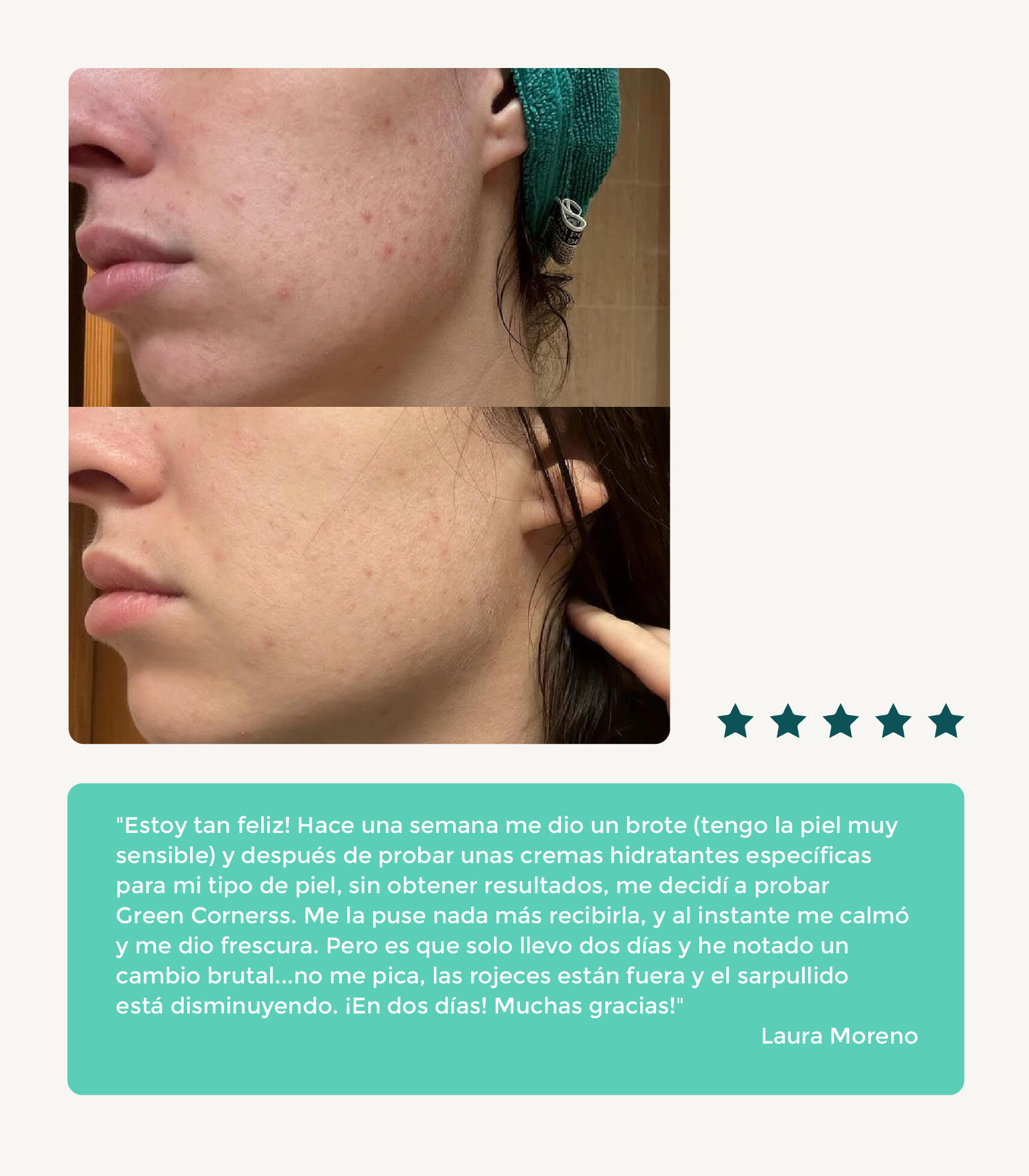 CREMA FACIAL DE REPOLLO 7/7
