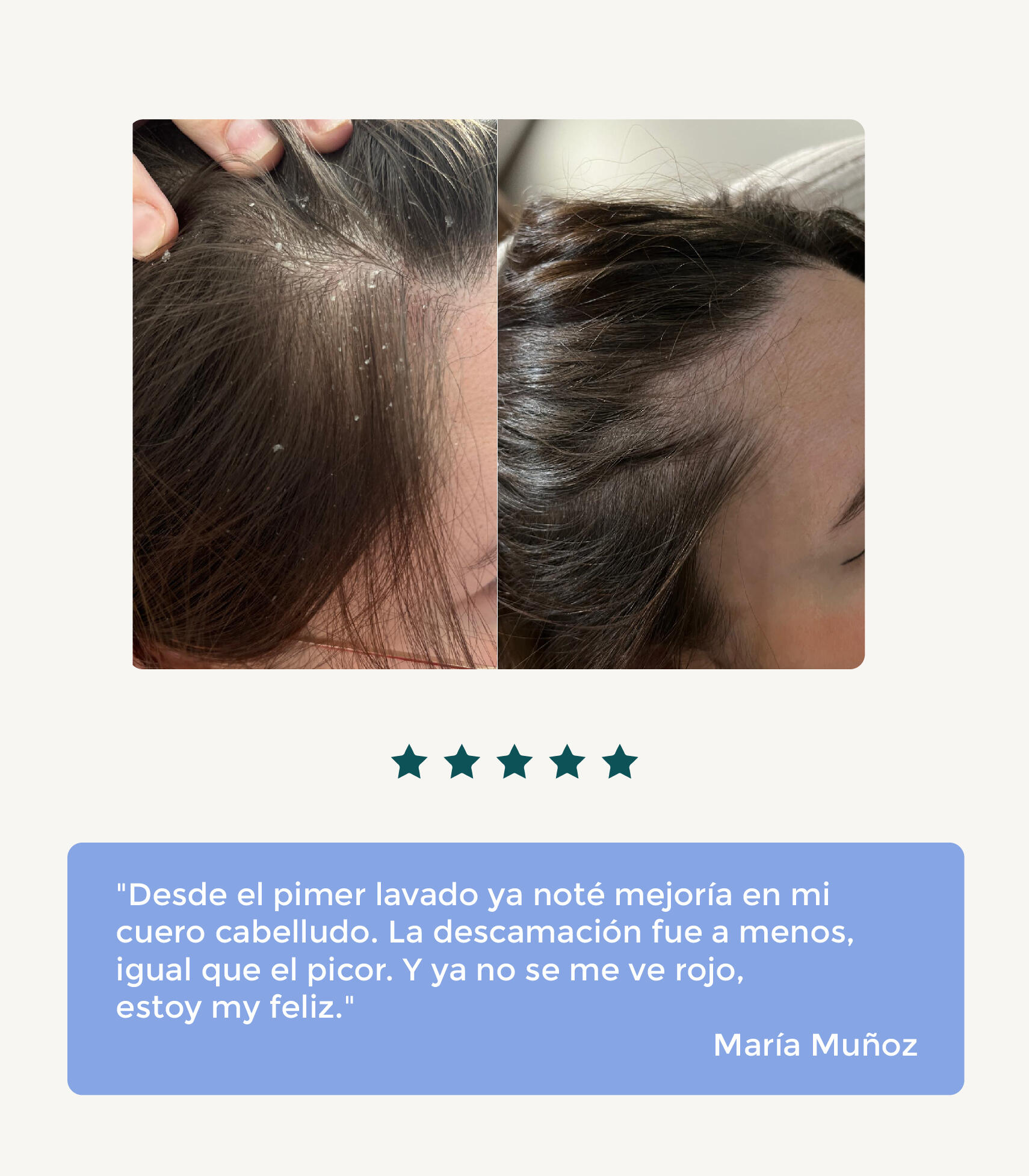 CHAMPÚ DE GUISANTE PARA CUERO CABELLUDO SENSIBLE 5/7