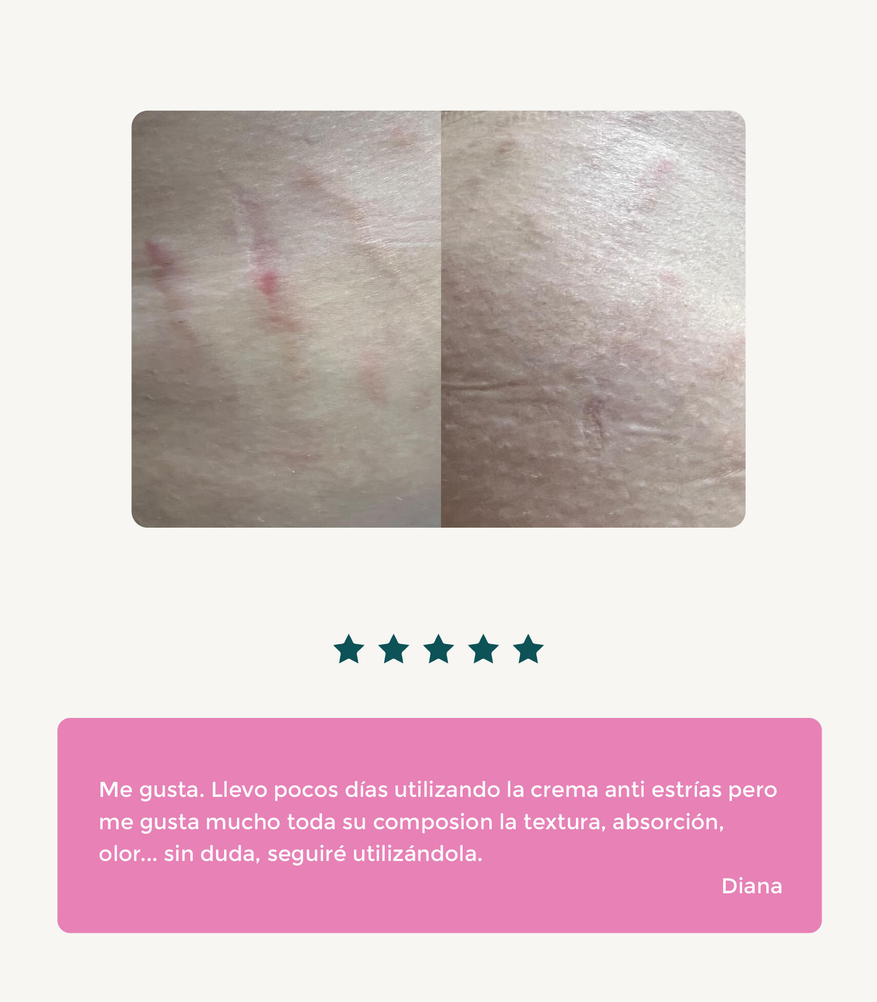 CREMA ANTIESTRÍAS DE SANGRE DE DRAGÓN 7/7