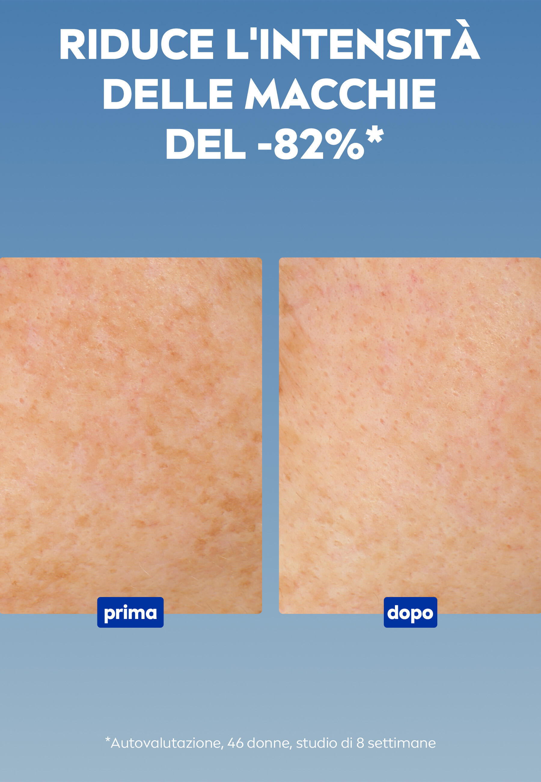 Siero Antimacchie Luminous630 – 30 ml per una Pelle Radiosa 5/7