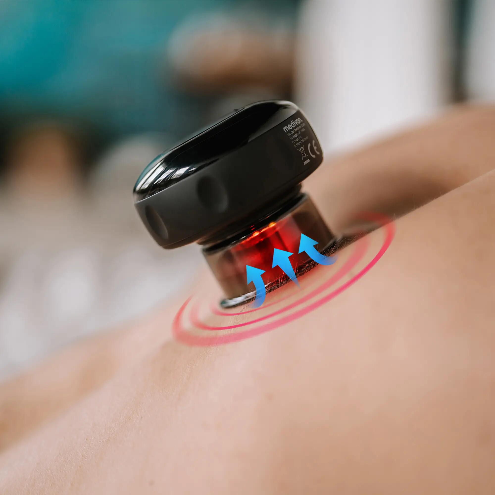 Bańka chińska do masażu masażer ręczny antycellulitowy Medivon Cushy 7/7