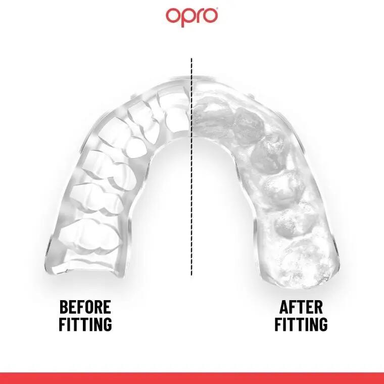 Protetor bucal Opro Instant Custom Fit - Polônia 4/5
