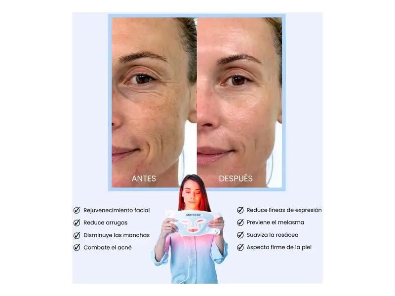 Professionelle LED-Gesichtsmaske gegen Hautalterung und Akne, AIR GLOW 7/8