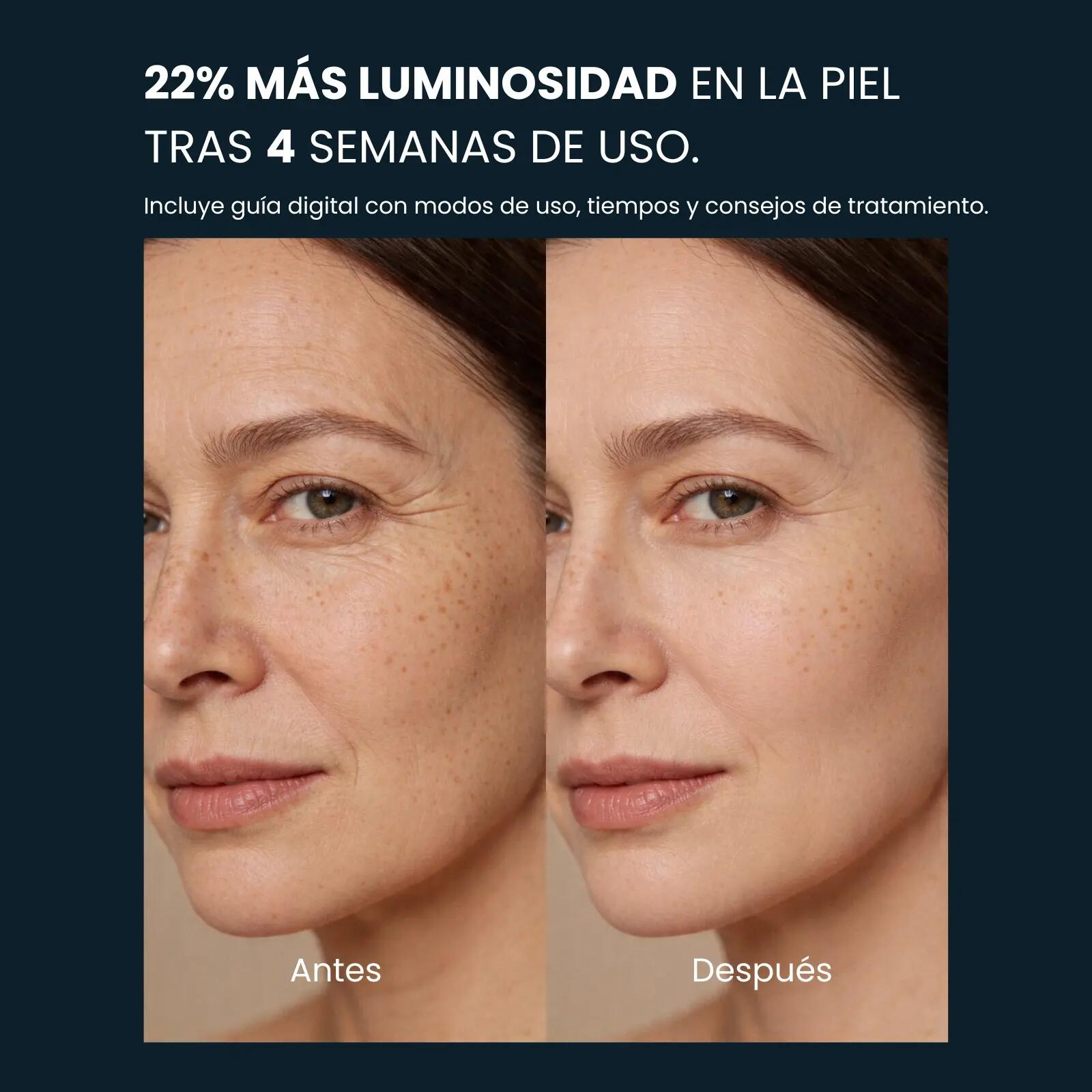 Maschera LED Viso WELLBEINN Redinn Mask, 4 Colori, Cura del Viso 5/7