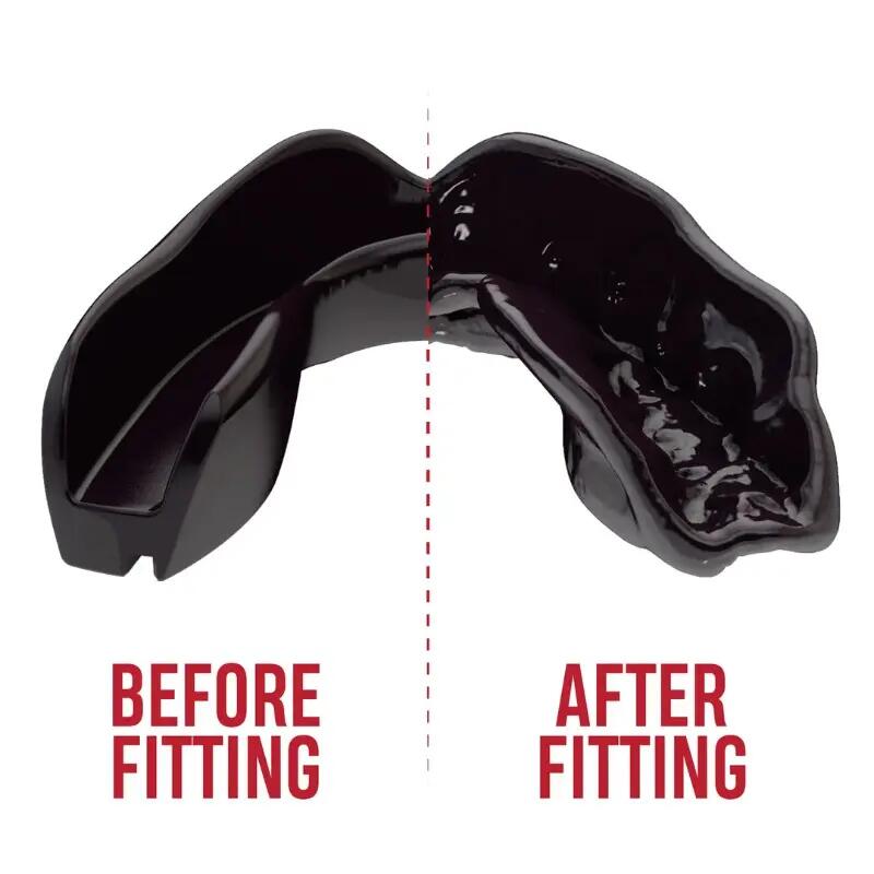 Protège-dents SAFEJAWZ Intro Series noir silicone 2/7