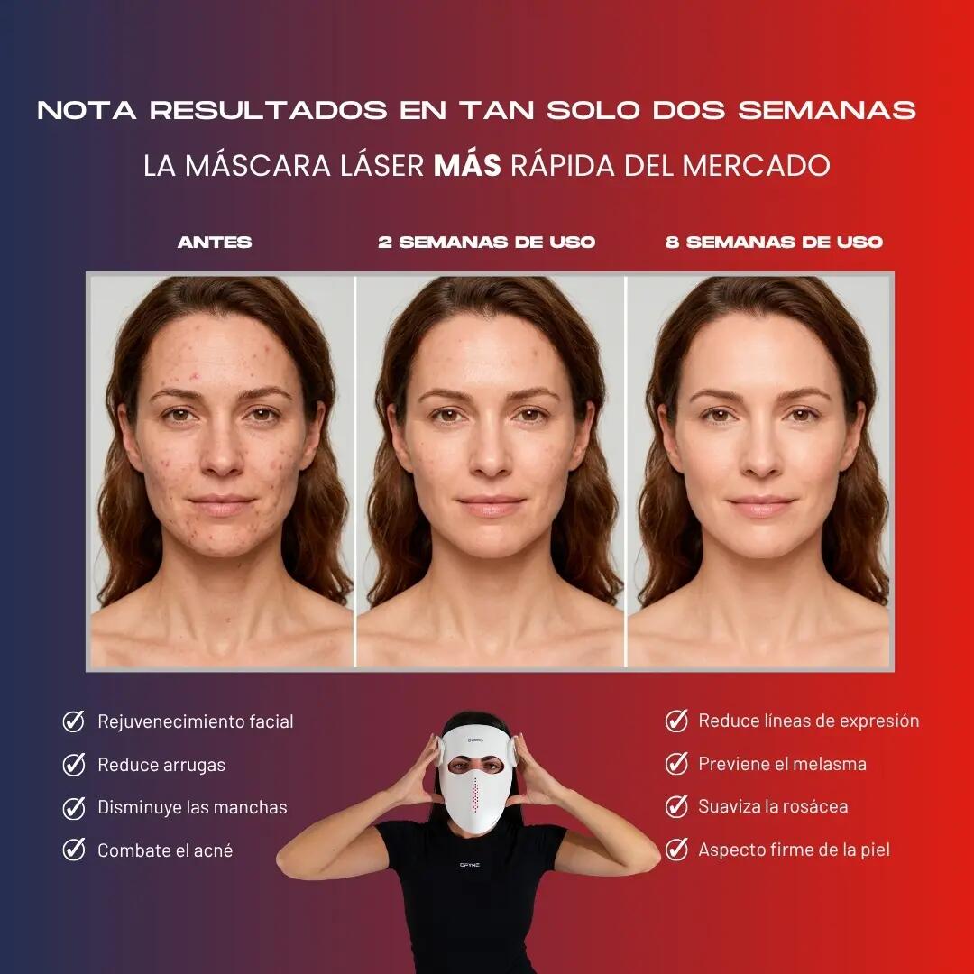 BT-MASK PRO - Masque laser 5/7