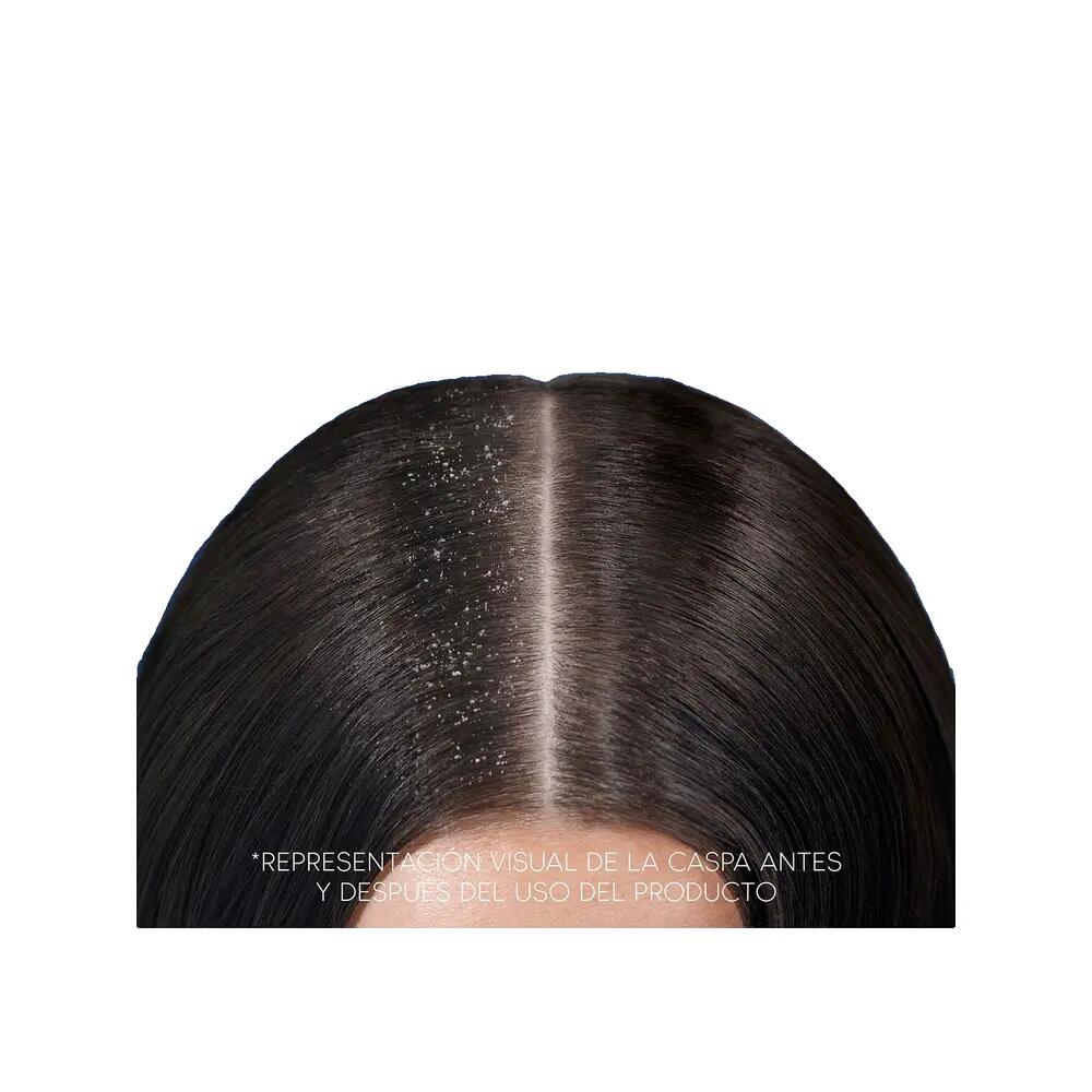 Shampoo Head & Shoulders Classic gegen Schuppen 7/9