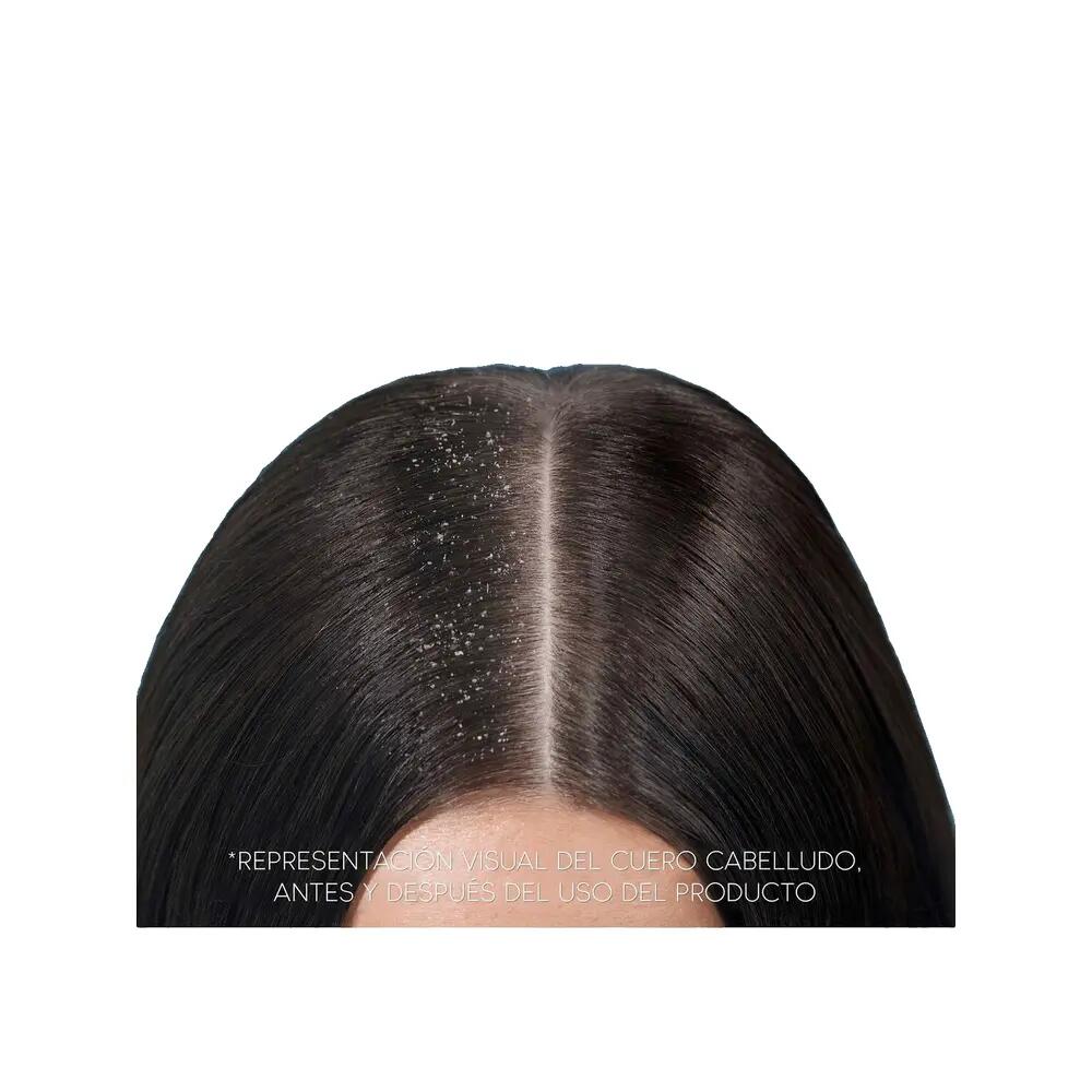 Shampoo Head & Shoulders Classic gegen Schuppen 4/9