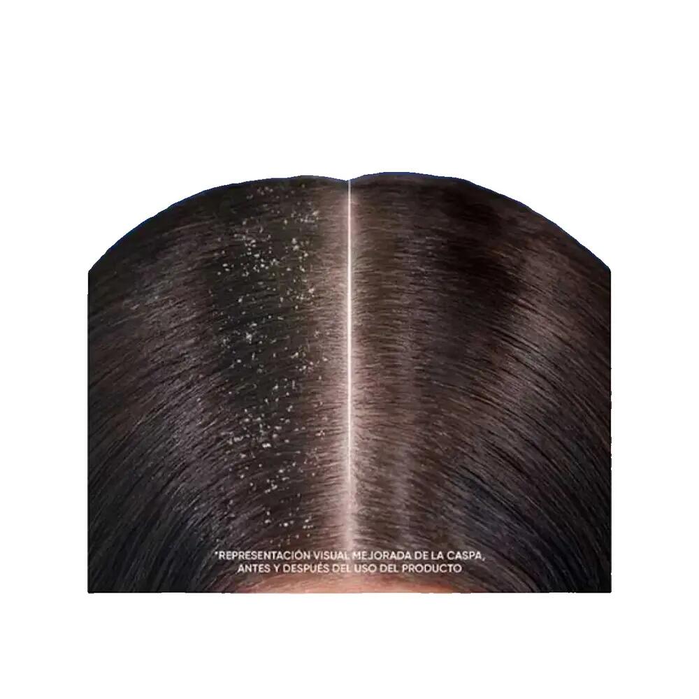 Shampoo Head and Shoulders Apfel 3/7