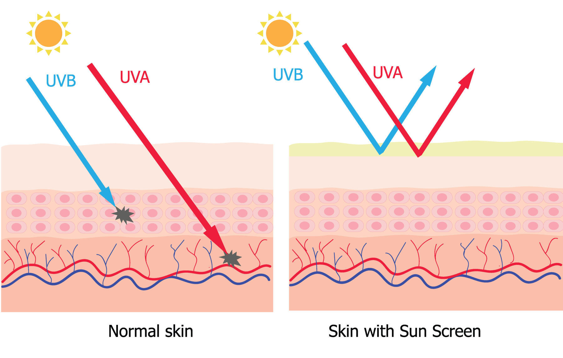 Comment protéger mon enfant du soleil ?