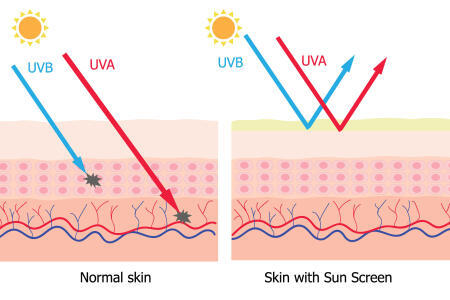 Rayonnement UV