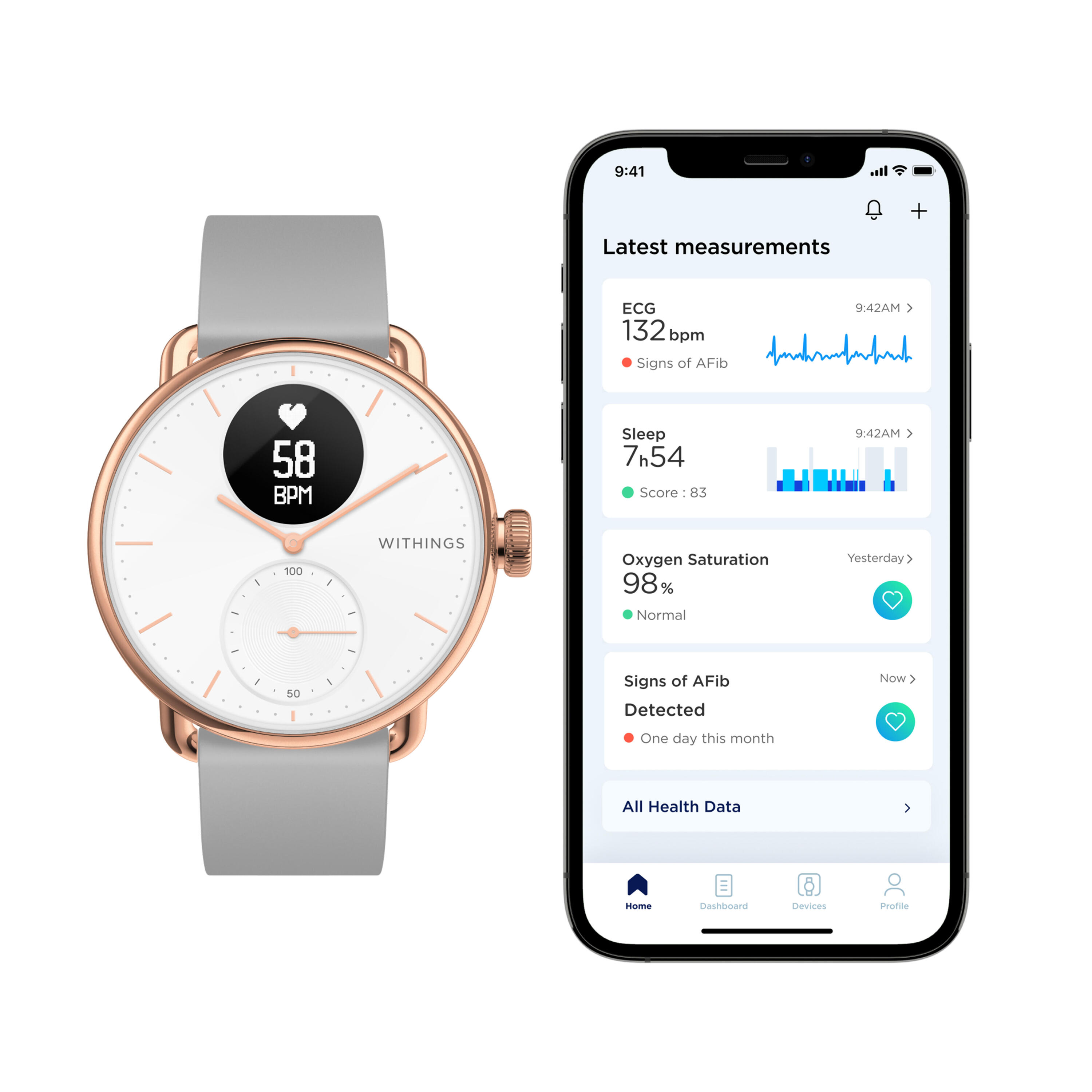 ScanWatch Withings GPS smartwatch - rose gold 2/8