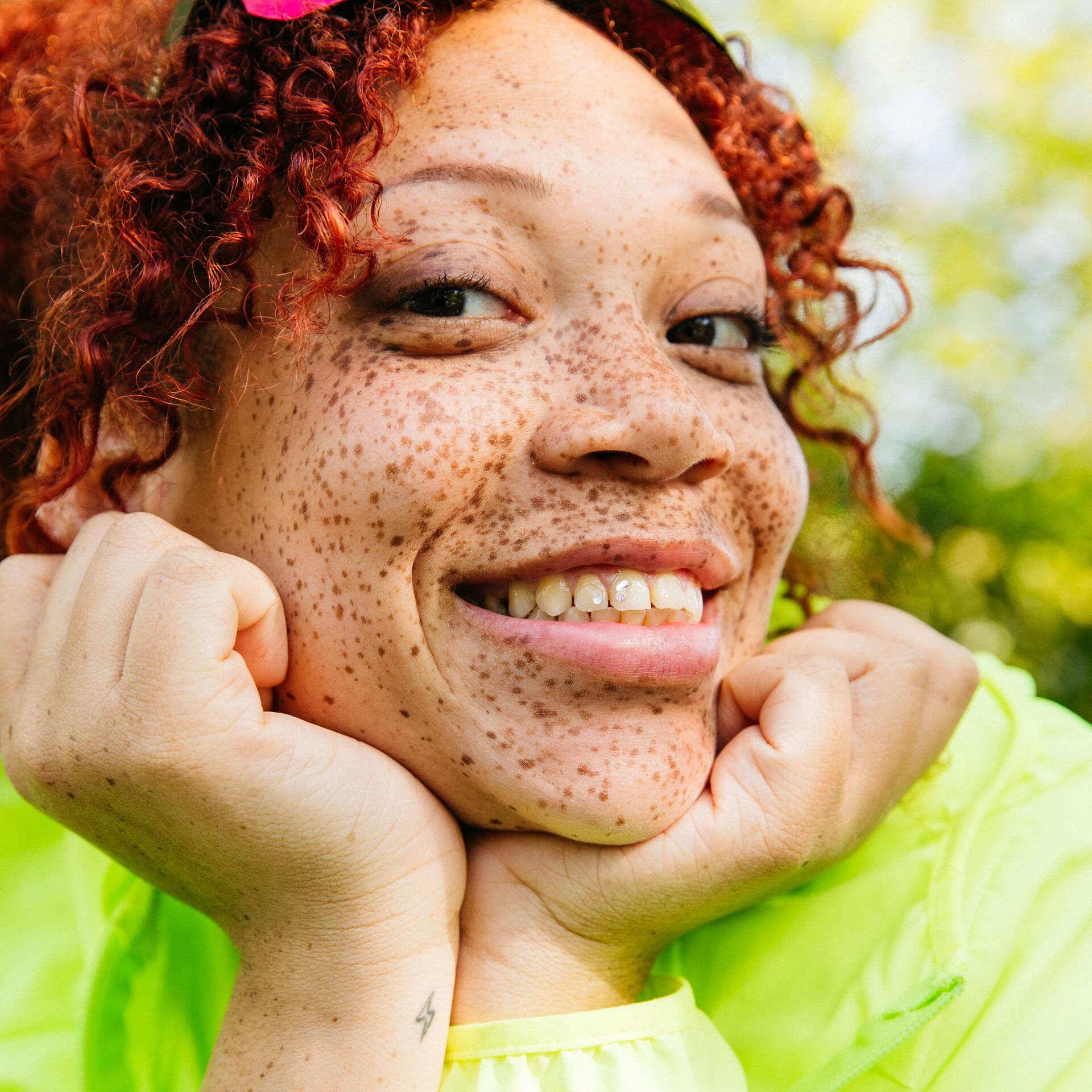 a woman with freckles posing and smiling 