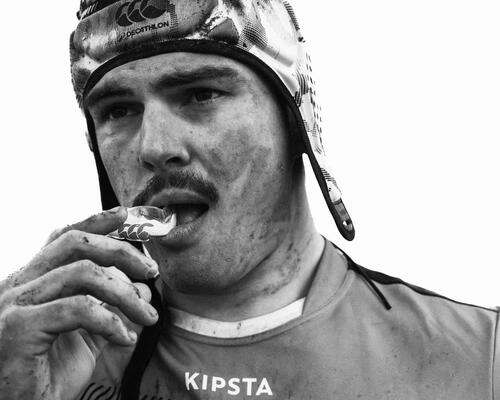 conseils-comment-choisir-et-mouler-son-protège-dent-de-rugby