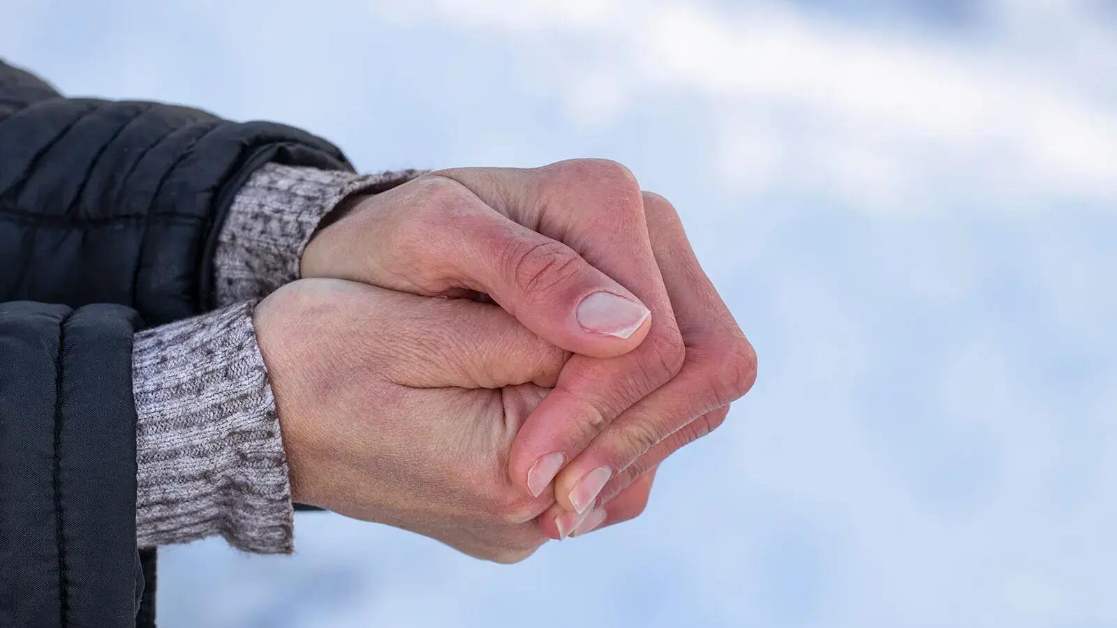 Osoba narażona na hipotermię ściskająca swoje dłonie na mrozie 