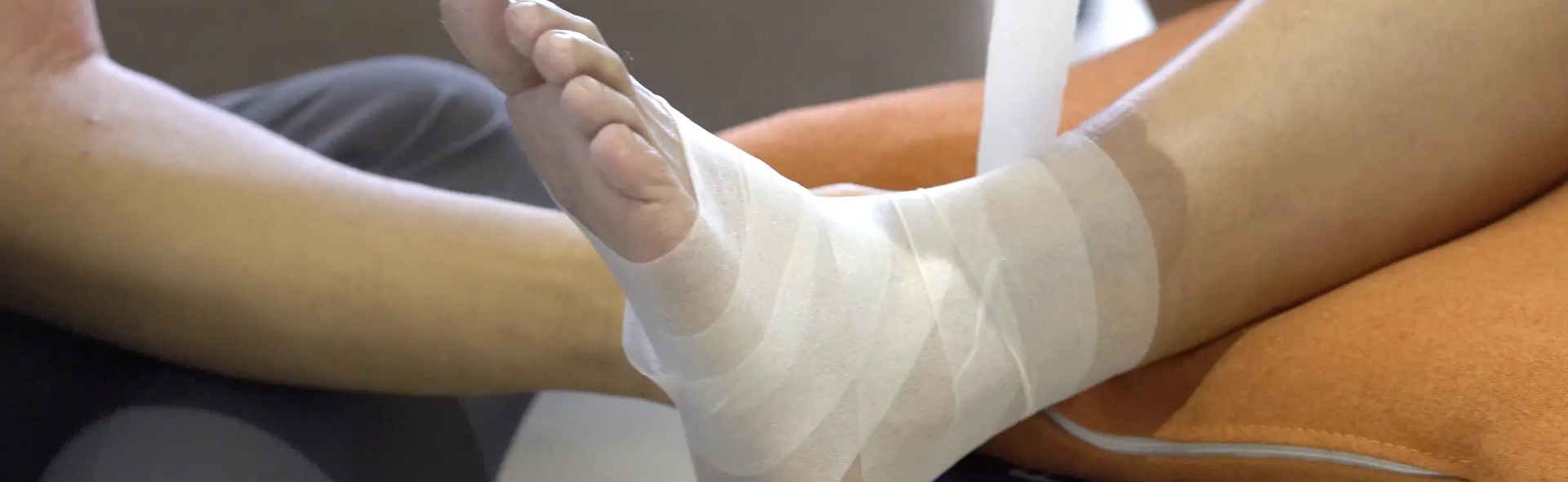How to Tape Syndesmosis High Ankle Sprain | Strapping Tape is feeling  wonderful. | By Strapping Tape | Que y which we call a high ankle sprain  which is a separation of